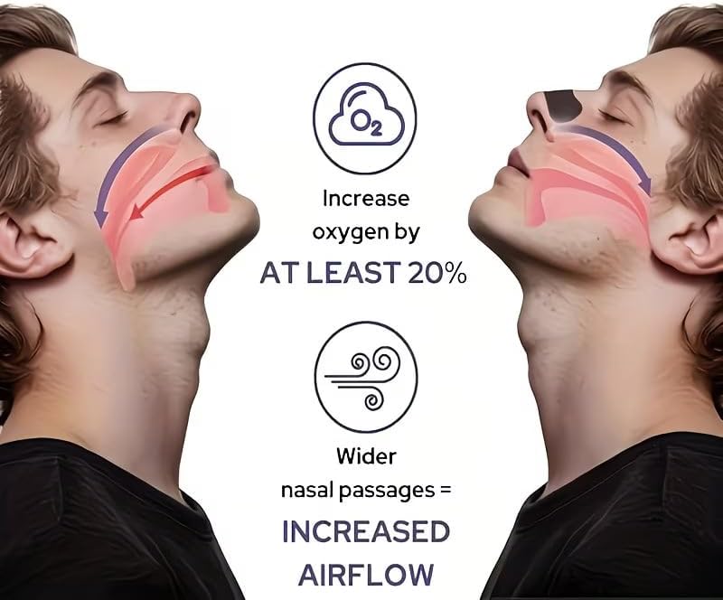 Nasal Strips (30 pcs)